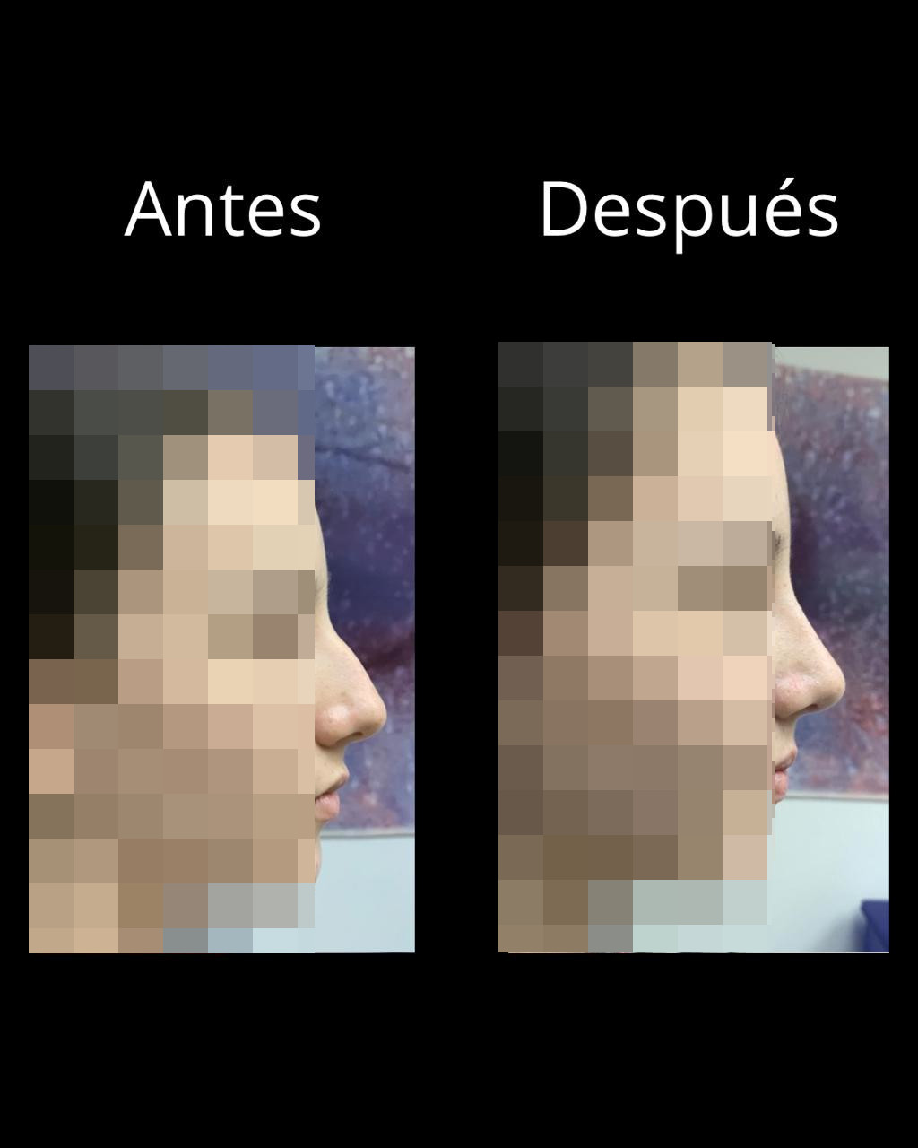 Antes