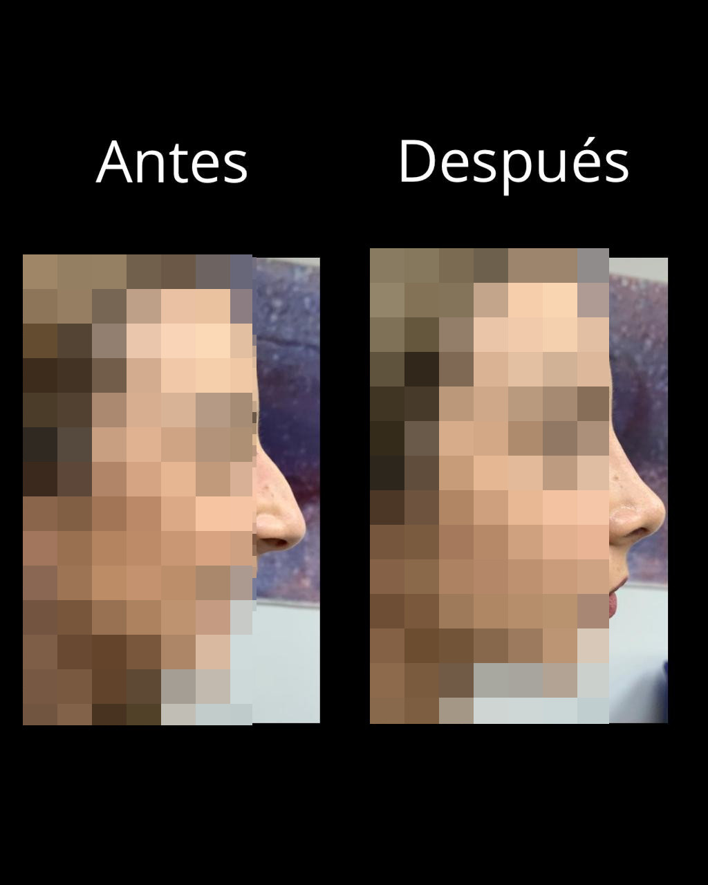 Antes