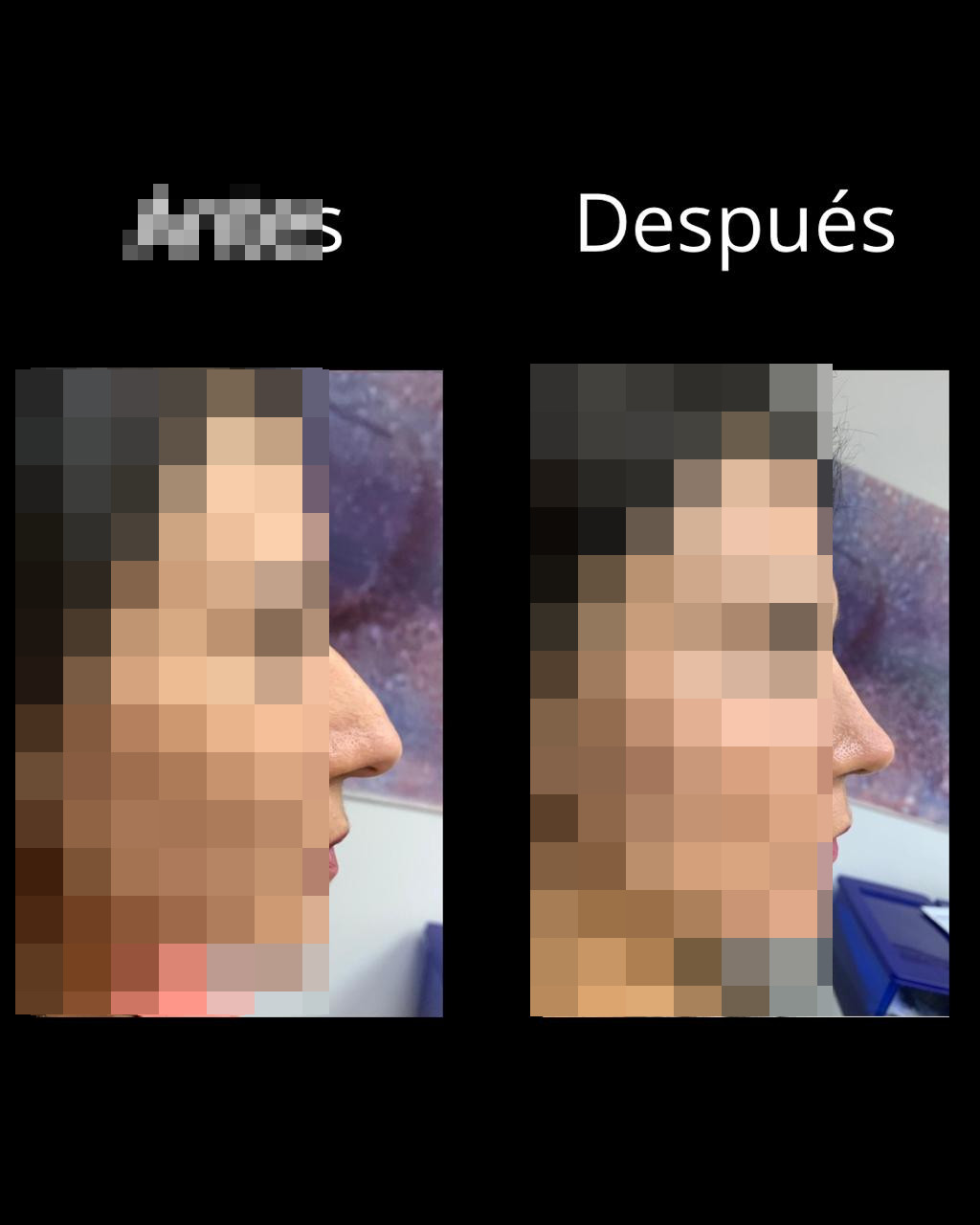 Antes
