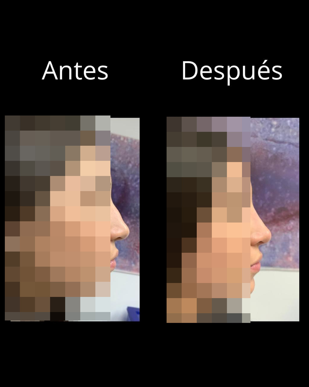 Antes